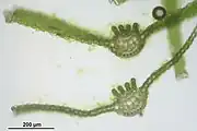 Vue au microscope d'une coupe transversale de feuilles d'Atrichum undulatum. On remarque les lamelles chlorophylliennes sur la nervure.