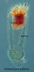 Climacocylis scalaria (Metacylididae).