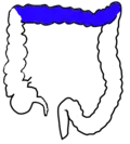 ColonTrasverso.png
