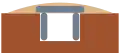 Coupe de ciste enterrée.