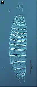 Echinoderes hwiizaa, un Kinorhyncha