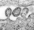 Virus de Lassa en fin de détachement de l'enveloppe virale.
