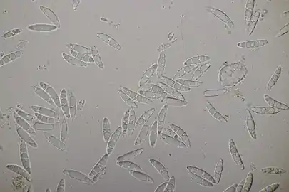 Leotia lubrica, ascospores multiguttulées