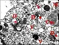 Fig.16 - Leptyphantes sanctivincentii - Organites d'un adénocyte, autre vue. Cm, corps myéloïde ; D, appareil de Golgi (dictyosome) ;  Ex, cavité extracellulaire ; Mt, mitochondrie ;  N, noyau ; P, plasmalemmes accolés ; V, vésicules. Flèches rouges : matériel lamellaire dans le Golgi