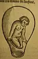 Position fœtale