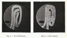 Agrandissement photographique de la coupe de deux sertis ; celui de gauche est incorrect car le métal n’est pas correctement recourbé et permet à l’air de s’infiltrer à l’intérieur de l’emballage, celui de droite est correct car les crochets constituants le serti sont parfaitement juxtaposés et jointifs.