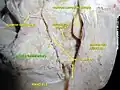 Artère labiale inférieure