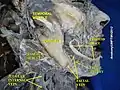 Dissection de la face montrant l'artère faciale. Vue de profil.