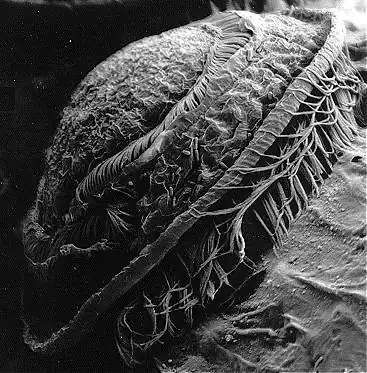 Trichodina sp. (micrographie électronique)