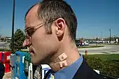 Homme présentant la trace d'une morsure par canines au cou.
