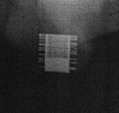 Radiographie d'un ZSI 375 implanté. Le dispositif est activé: le ressort est au niveau du sommet du cylindre. Le patient est continent.