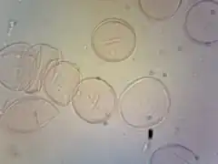 Pollen.